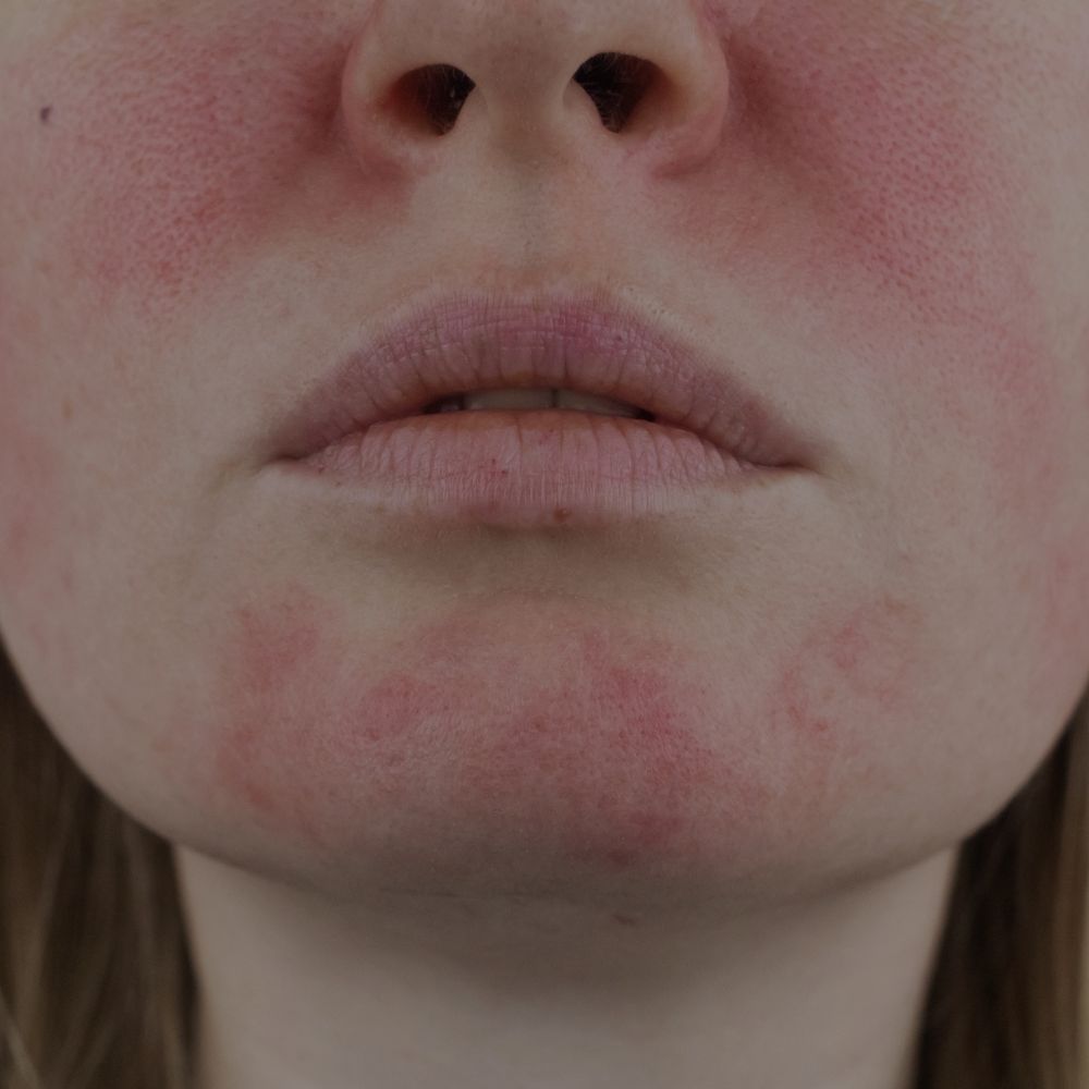Routine soins naturels rougeurs irritation