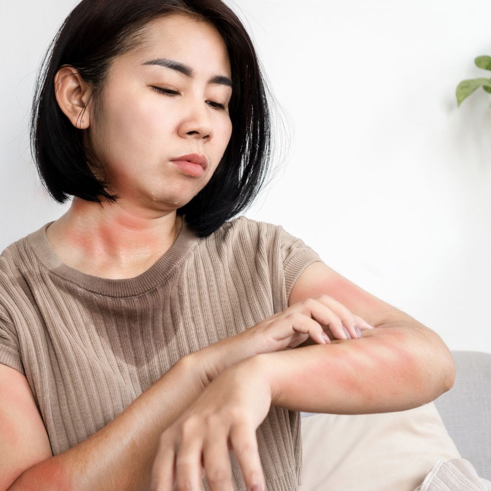 Femme ayant des boutons de chaleur