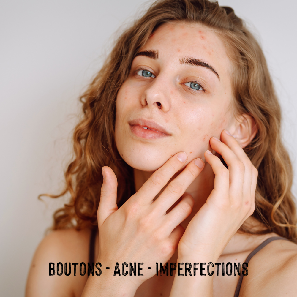 Bouton sur le visage : comprendre, prévenir et traiter efficacement