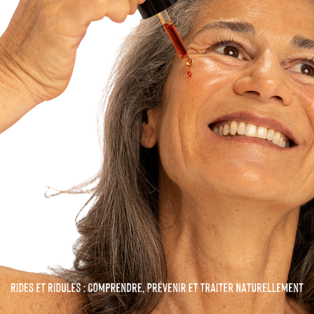 Rides et Ridules : Comprendre, Prévenir et Traiter Naturellement