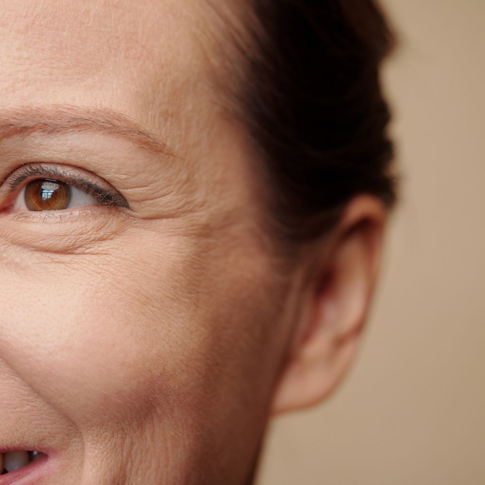 Photo femmes avec ridules au coin des yeux